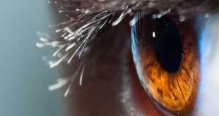 Phone Burned 500 Holes In Woman's Eye